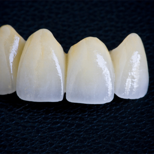 https://www.sivpdental.es/wp-content/uploads/2023/04/PROTHESE-CONJOINTE-300x300.png