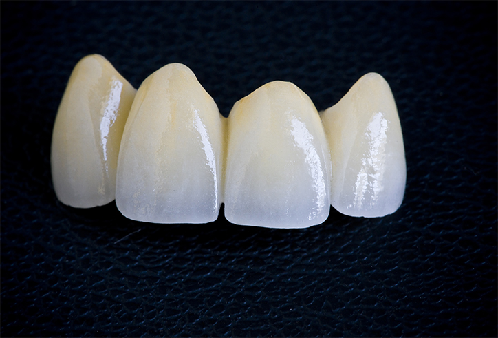 https://www.sivpdental.es/wp-content/uploads/2023/04/PROTHESE-CONJOINTE.png