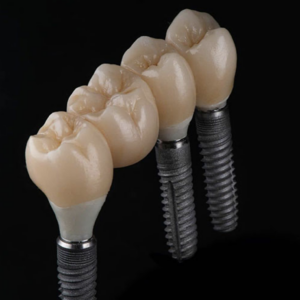 https://www.sivpdental.es/wp-content/uploads/2023/05/Capture-decran-2023-05-08-a-15.10.49-300x300.png