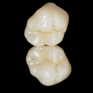 https://www.sivpdental.es/wp-content/uploads/2023/05/Couronne-full-zircone-multicouches-1-300x300.jpg