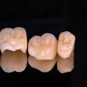 https://www.sivpdental.es/wp-content/uploads/2023/05/Couronnes-Emax-300x300.jpg