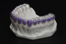 https://www.sivpdental.es/wp-content/uploads/2023/05/goutierre.jpg